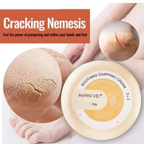 🎁Anti-Cracking Frost